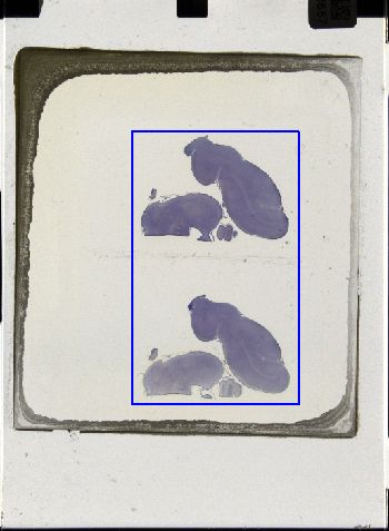Media type: image; Special Collections 3043   shows specimen_part histological serial section;